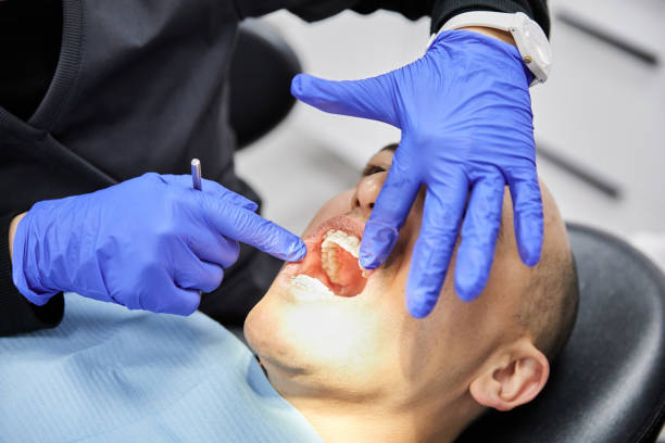 Best Emergency Dental Care for Trauma or Injury in Monfort Heights, OH